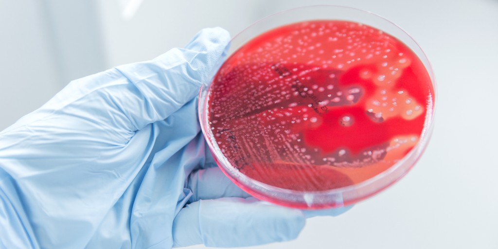 📢🦠 Now open for applications: <a href="/imperialcollege/">Imperial College London</a> Academic Clinical Fellowship in Infectious Disease (with General Internal Medicine / Medical Microbiology or Medical Virology) hosted by us + <a href="/Imperial_AID/">Adult Infectious Disease</a>.

✍️ Deadline: 2 November
🔗 Learn more and apply: ow.ly/i7OZ50L5x4x