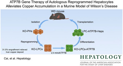 HEP_Journal's tweet photo. #HEP_highlights October: Engineering a Copper Exit Strategy
Cai H et al. Novel gene therapy strategy reintroduced functional #ATP7B back in the livers, reducing copper accumulation in a mouse model of #Wilson’s Disease
#LiverTwitter
https://t.co/S48VuDKGEN https://t.co/l3XiZ4fqAW