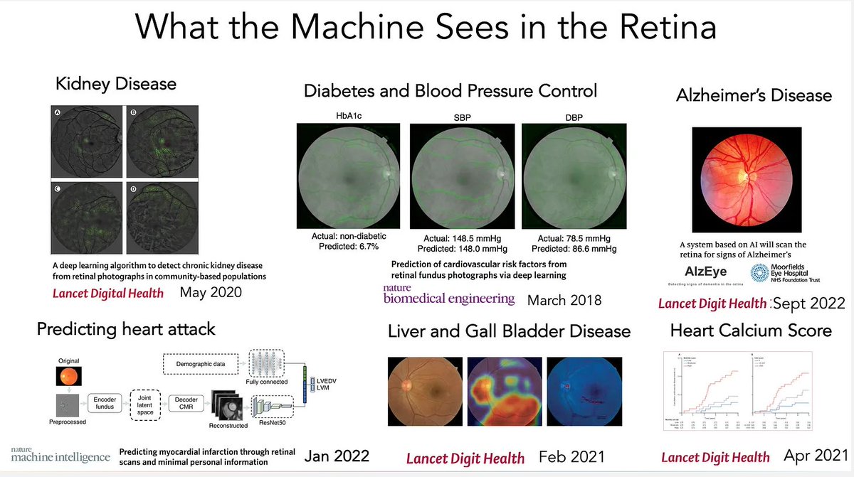 @erictopol The unanticipated deep learning A.I. dividends for medicine: taking a photo of your retina via your smartphone to get an accurate readout of many of your body systems/ organ functions. erictopol.substack.com/p/the-amazing-… @EscenariosUdeSA @julitoalonso @cscolari @GabrielTorresEs