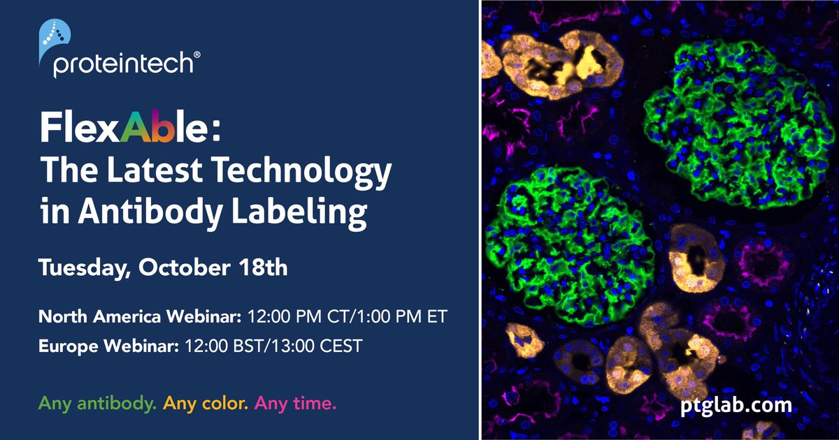 Meg Elley (@meg_elley) on Twitter photo FlexAble: The Latest Technology in Antibody Labeling
18th October 12pm BST/1pm CEST
Join <a href="/Proteintech/">Proteintech Group</a>’s webinar and learn about FlexAble, a novel antibody labeling kit! Sign up using this link here: ptglab.zoom.us/webinar/regist… FlexAble: The Latest Technology in Antibody Labeling
18th October 12pm BST/1pm CEST
Join <a href="/Proteintech/">Proteintech Group</a>’s webinar and learn about FlexAble, a novel antibody labeling kit! Sign up using this link here: ptglab.zoom.us/webinar/regist…