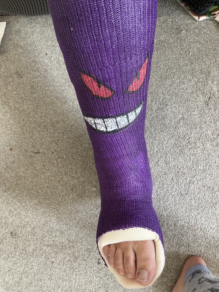 DinknBopsMama's tweet photo. Ready for spooky season! Yes he’s lopsided lol #spookyseason #pokemongo #gengar #brokenankle #purplecast #halloweenready https://t.co/m2L3qdnh7t