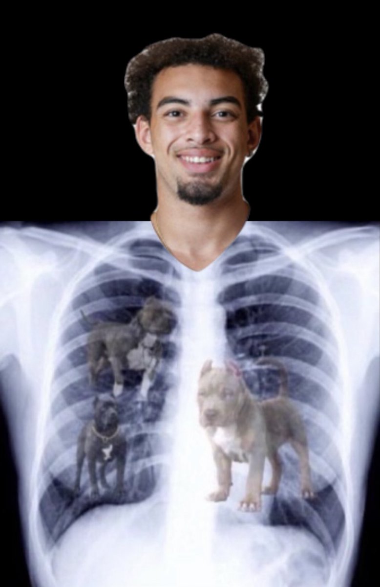 BarstoolPU's tweet photo. Got the results back from @devin_mockobee’s x-ray. Boy got the dawg in him😤 https://t.co/lIDx7VUJFn