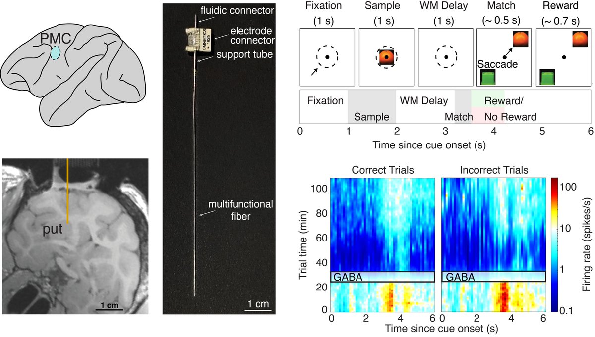 Bioelectronics @ MIT (@anikeevalab) on Twitter photo Our lab’s first NHP study using flexible fiber neurotechnology is now online.
In collaboration with <a href="/MillerLabMIT/">Earl K. Miller</a>, <a href="/IndieGarwood/">Indie Garwood</a> investigated local inhibition of the premotor cortex and putamen during cognitive behavior.
biorxiv.org/content/10.110… Our lab’s first NHP study using flexible fiber neurotechnology is now online.
In collaboration with <a href="/MillerLabMIT/">Earl K. Miller</a>, <a href="/IndieGarwood/">Indie Garwood</a> investigated local inhibition of the premotor cortex and putamen during cognitive behavior.
biorxiv.org/content/10.110…