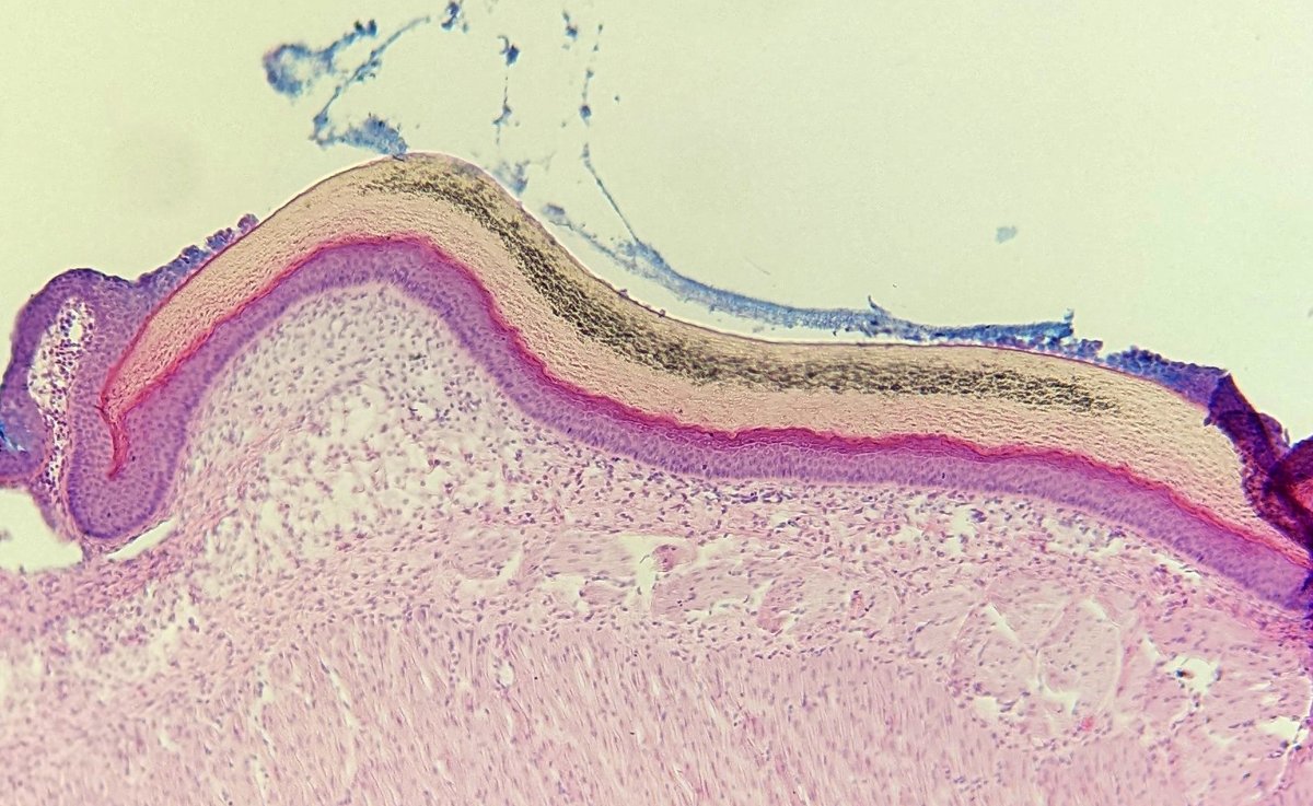 garethjfraser's tweet photo. Check out this H&E stained paraffin thin-section through a juvenile Lamprey (Petromyzon marinus) keratodont (keratin tooth) from the oral disc. No dentine, no enamel, just keratin. Produced entirely from epithelial tissues.🦷#jawless #lamprey #histology #keratodont #vampirefish https://t.co/dPmjxfYSw2