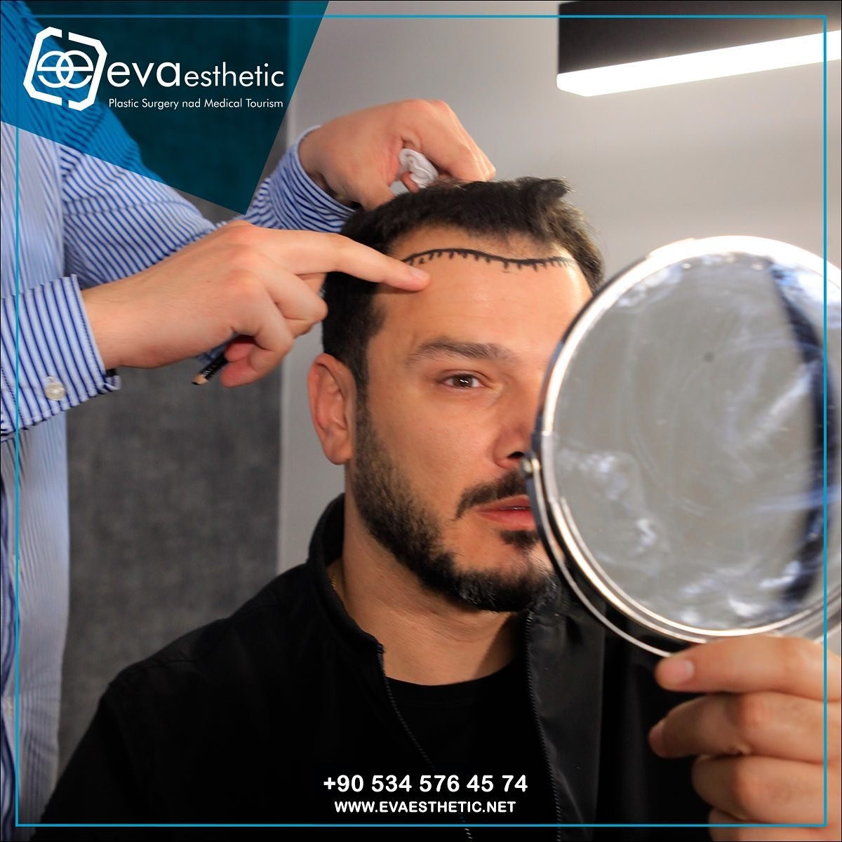 Eva Esthetic | Hair Transplant ✔️.
.
Hair transplantation in Turkey Istanbul
The best EVAEsthetic.net Hair Transplant Hospital In Istanbul 🇹🇷
-#HairTransplantation
-#ForeheadReduction
-#EyebrowTransplant
-#BeardTransplantation 🔗👇
Book now via📲:WhatsApp;📲 +905345764574
