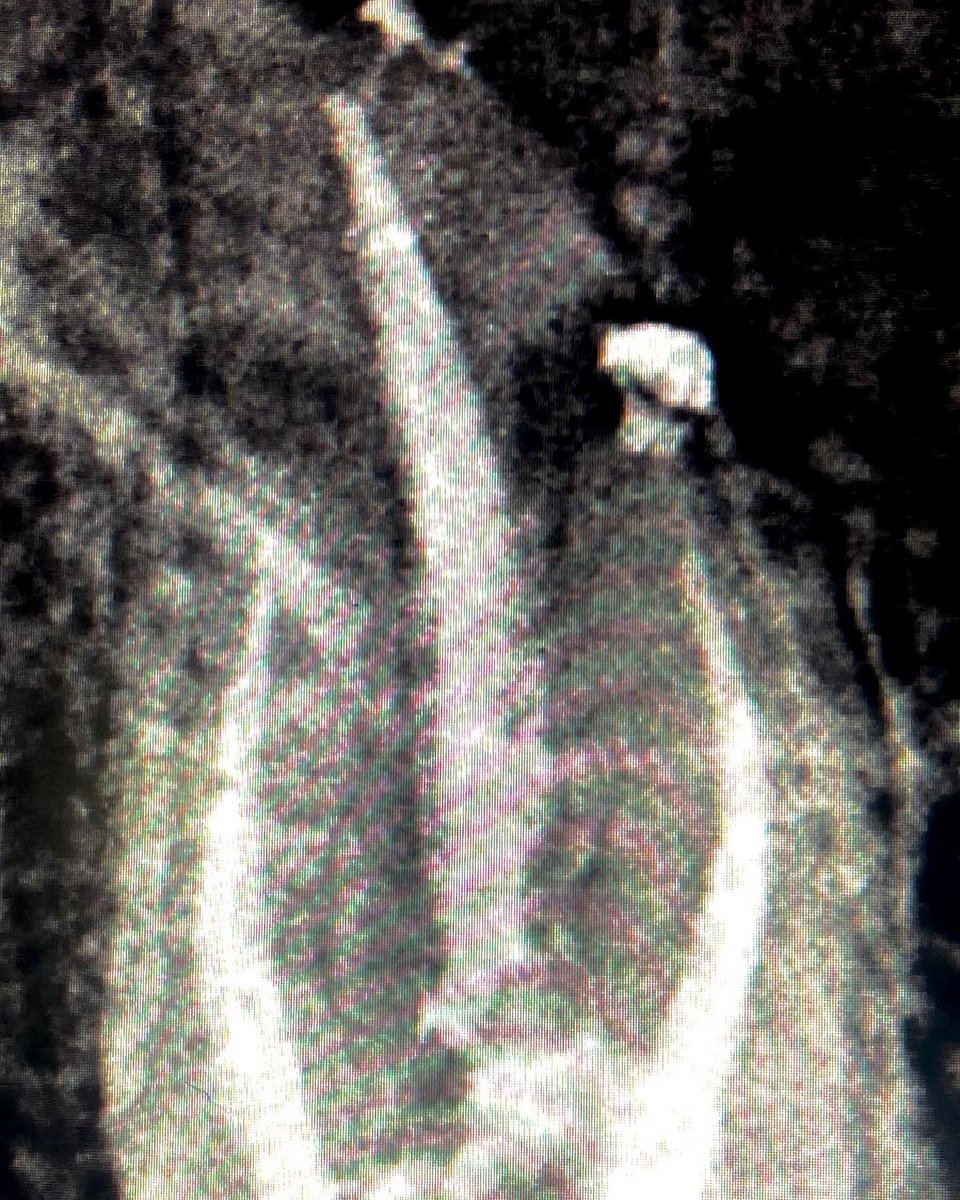 drpmdfuentes's tweet photo. Empezamos la #semana con #endodoncia en #pieza26 de #4conductos #multirradicular ☝️☝️Tratamiento con #protapernext y #obturacion con #gutaperchatermoplástica y #calamusdual en @sanitas #dresquerdo @_clinicadental ¡Ayudar al #paciente la mejor forma de arrancar la semana! 🦷 https://t.co/1zXGzeMdeG
