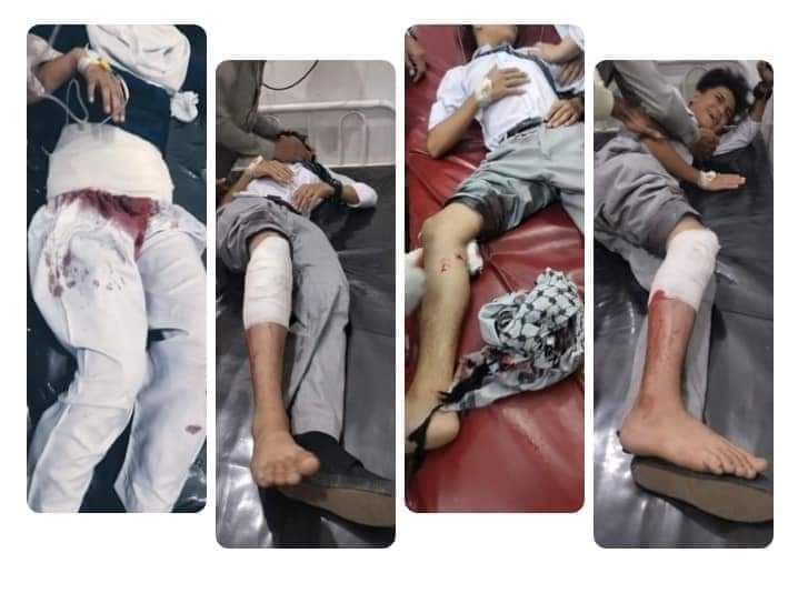 د پښتونخوا په سوات سیمه کې، د کوچنیو زده کوونکو په موټر برید د اسلامي او انساني اصول خلاف عمل دی.
د لوی افغان دښمن هر ځای، د تعلیمي او علمي زده کړو مرکزونه ددې لپارت هدف ګرځوي، ترڅو افغانان له زده کړو بې برخې او د نیابتي جګړې د سون توکي اوسي.