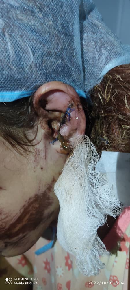 lalogitud's tweet photo. #URGENTE
Wuiliani García,entre las personas qué se encontraban en el autobús que fue arrastrado por el deslave..
 madre de la niña desaparecida en Las Tejerias...se encuentra en shock,solo pregunta por su hija..por favor ayudemos para que le den respuesta a sus familiares.
🚨🚨😞 https://t.co/eaITiCXtJK