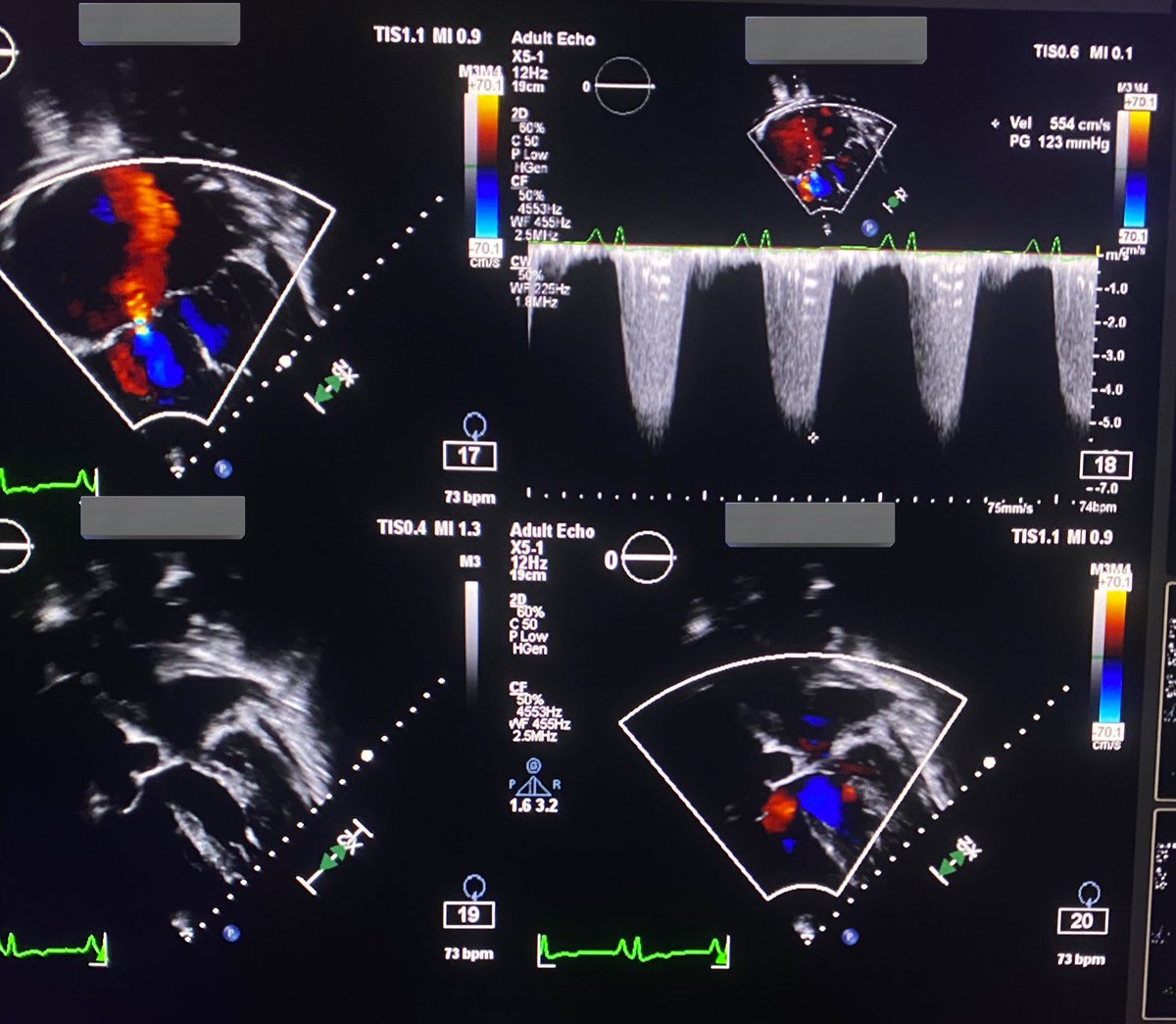 _AAQ98's tweet photo. 🫀| I did My First #Echocardiography as an Internship  

‘
- I'm really happy with the level I've reached in Cardiovascular 🤍✅

In PSCCQ, 10.10.2022 https://t.co/Ish998KIcj