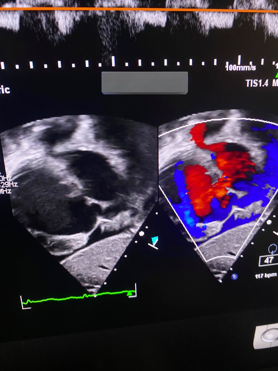 _AAQ98's tweet photo. 🫀| I did My First #Echocardiography as an Internship  

‘
- I'm really happy with the level I've reached in Cardiovascular 🤍✅

In PSCCQ, 10.10.2022 https://t.co/Ish998KIcj