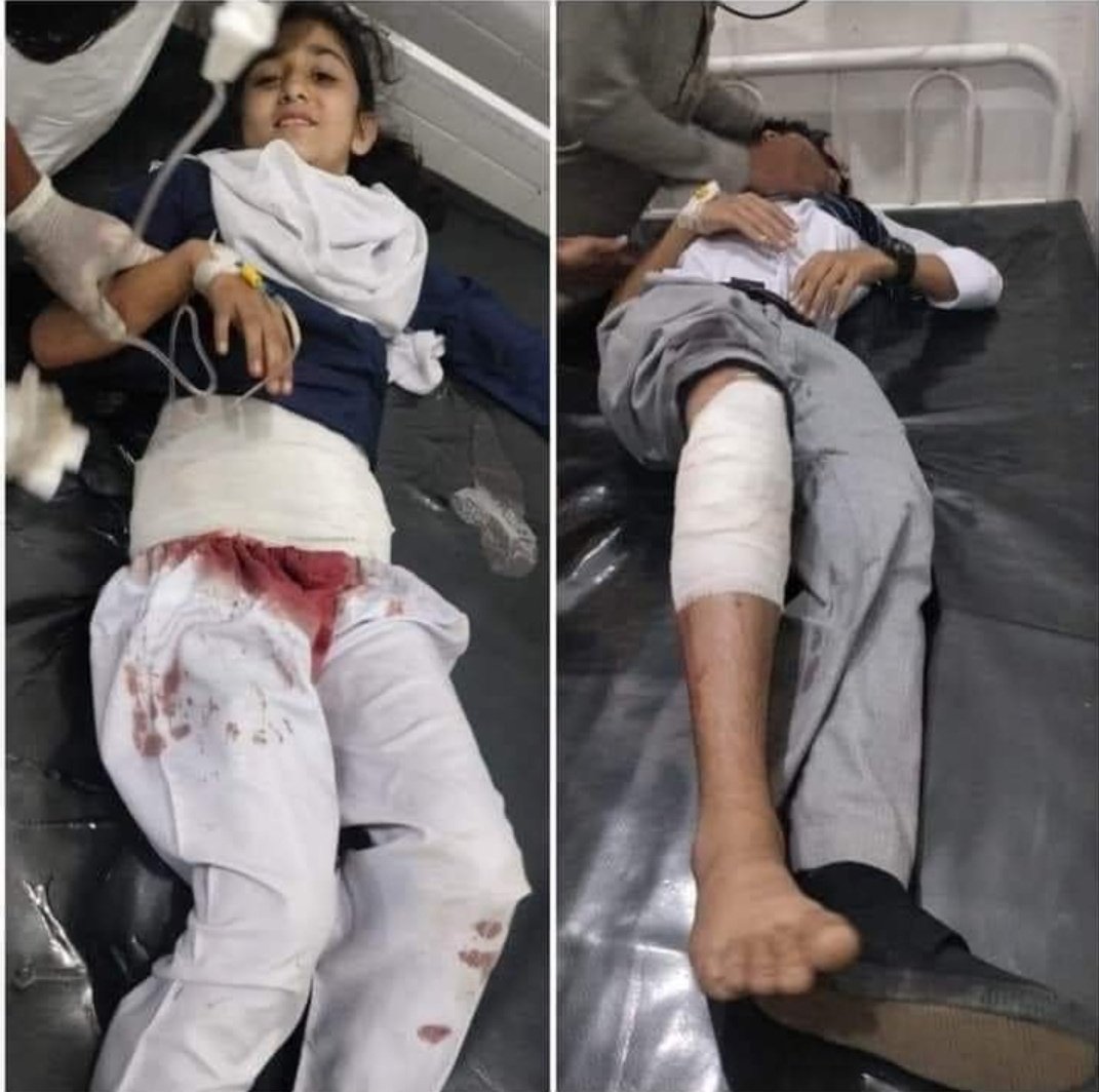 Naeemullah1999's tweet photo. We aren't safe even in our own country. This happened today in Swat Pakistan. Why pashtoons are always targeted by them?
Why the higher authorities are still quiet?
@CommissionerHR
#HumanRightsViolations
#HumanRightsViolation 
#HumanrightsAttacks 
#SwatRejectsMilitancy 
#swataman https://t.co/2Y5zhkYXas