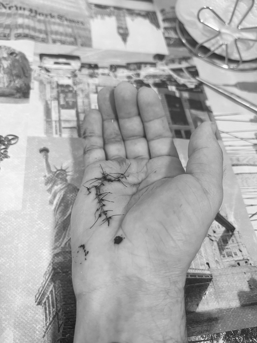 BorjaGonzalezRo's tweet photo. 16 días desde que me corte los tendones de 2 dedos, 15 desde la operación. Hoy me han quitado los puntos☺️ queda menos para que esta cabra montesa vuelva hacer todo lo que le gusta. https://t.co/2CpUj62S9D