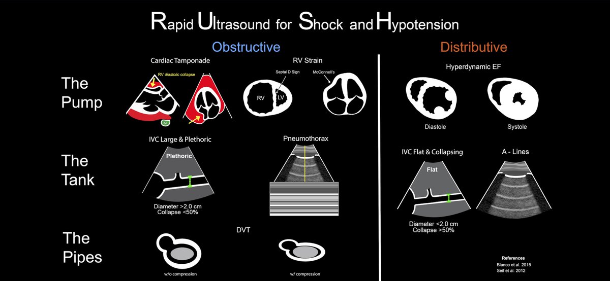 dan___kim's tweet photo. More cards from @ACEP_EUS critical care subcommittee. This set is on the RUSH protocol and different shock patterns.
#echo #echofirst #POCUS 
https://t.co/LhO8RuQpRE https://t.co/peBuLIBxcn
