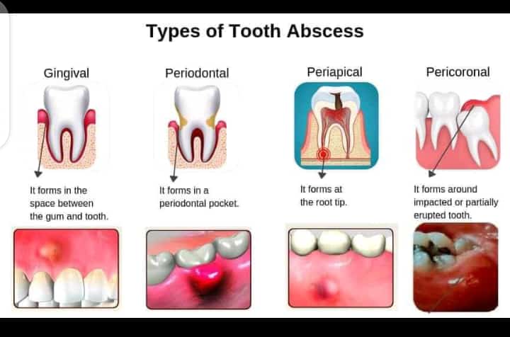 You should see your dentist now n then