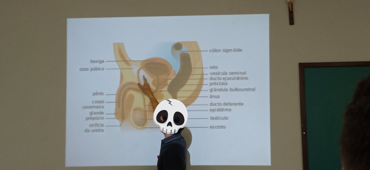 lopsit4's tweet image. Entrei na faculdade pra jogar vôlei, to estudando pinto agora