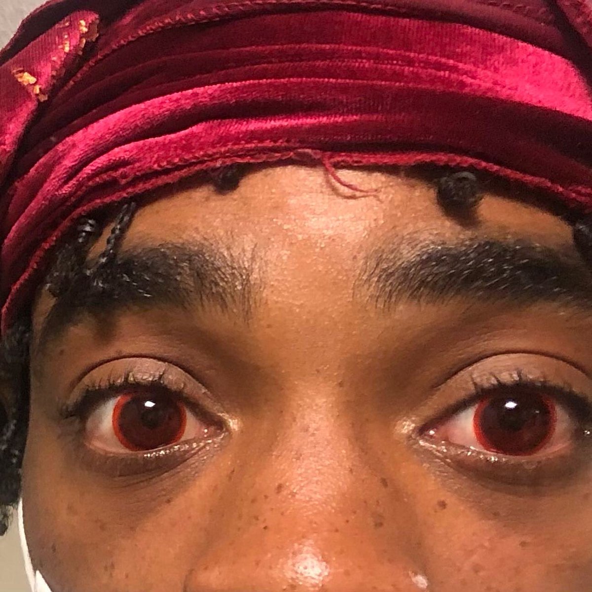 Katherine K. Weise, OD, MBA, FAAO tweet media