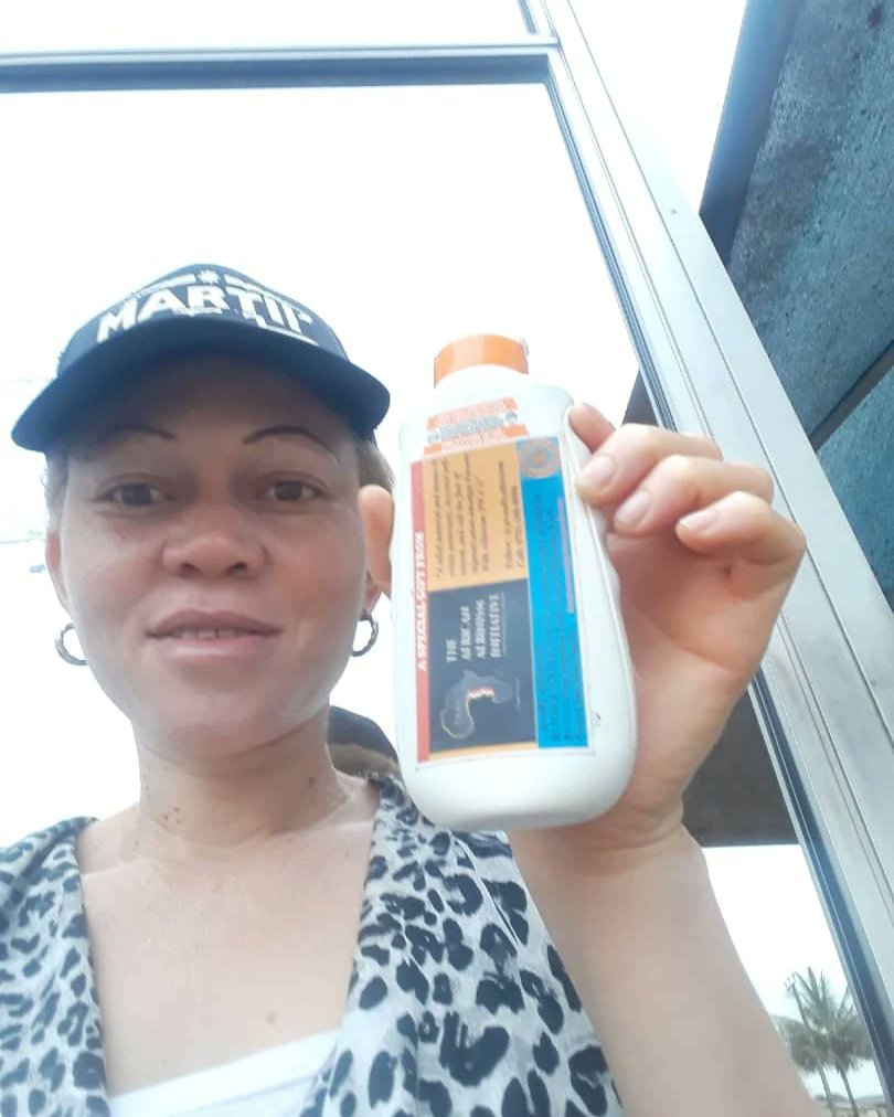 ProudlyAlbinism's tweet photo. As the love keeps spreading courtesy of Human Race Diagnostic and Specialist Huspital Owerri, we call on well meaning individuals to kindly support the project so that we can reach out to more vulnerable persons with albinism in our communities
#PeterObi4President2023
#ASUUstrike https://t.co/CfurkcMswR