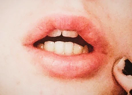 I have one little sharp tooth 