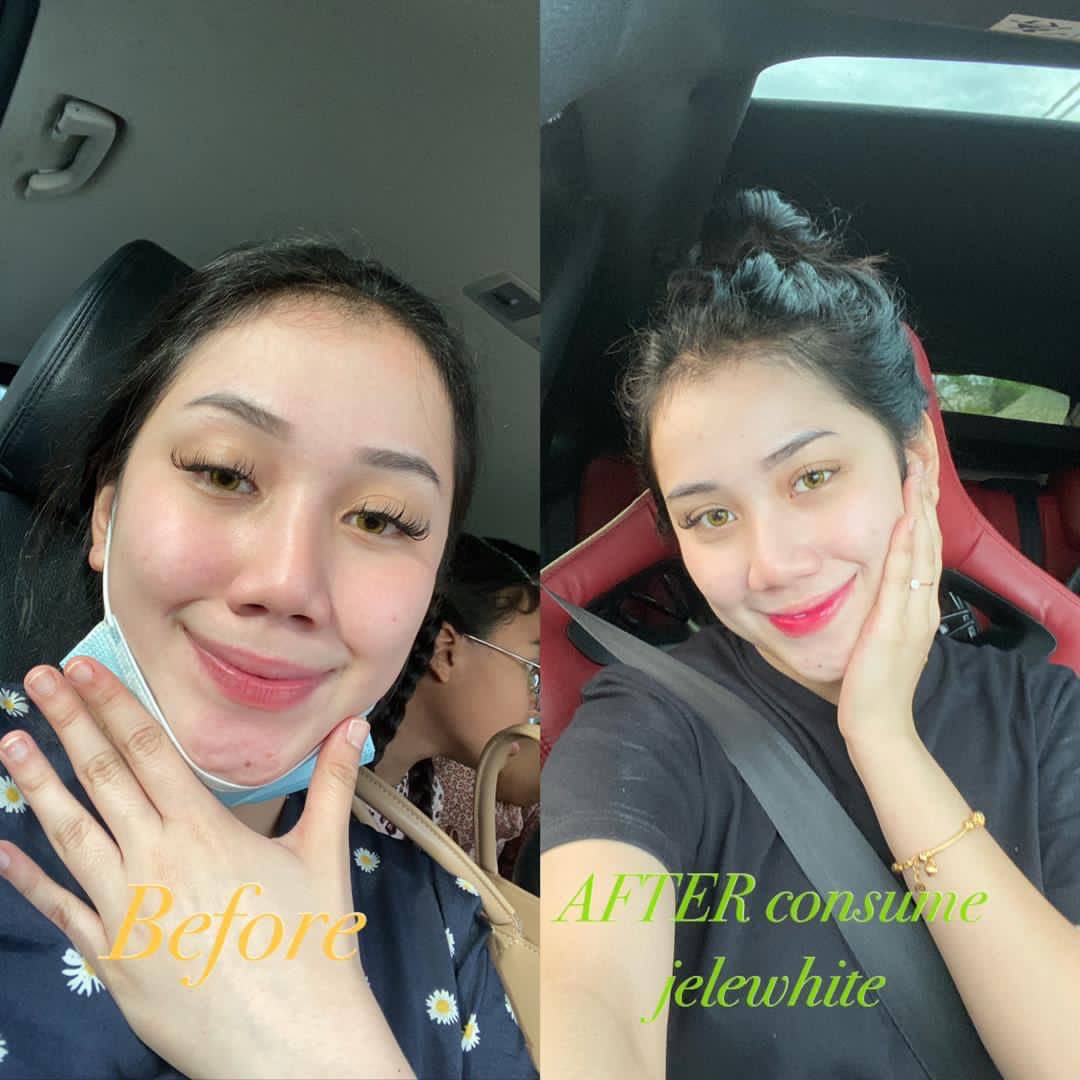 RaraSweet__'s tweet photo. Dah putih, makin putih 🥰😍 https://t.co/7QgKQLvdjy