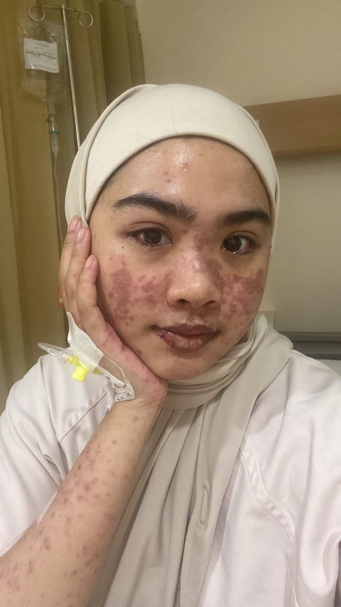 afinasyif's tweet photo. ga nyangka aku masih hidup sekarang setelah mencoba suicide attempt 5x dan berarti aku bisa menghadapi obstacles yang ada di kehidupan ini?! sempat juga ketika sakit sjs kepikiran untuk suicide karna ngerasa ko dunia ga adil eh tapi aku bisa ngelewatin itu semua! HUA KEREN AKU! https://t.co/LlA4N9INbS