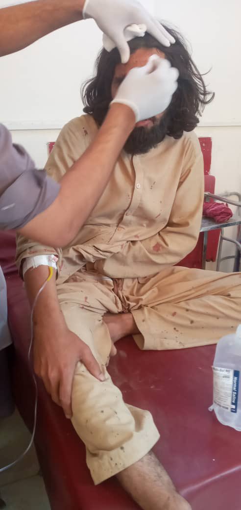AbdulhaqOmeri's tweet photo. د لغمان الینګار والسوالۍ نورلام صاحب دره کې نن شاوخوا لس بجې د طالبانو پر یو رنجر موټر ماین چاودنه شوې ده .
په دغه چاودنه کې درې طالبان وژل شوي او پنځه نور ټپېان دي. https://t.co/PXV0RlMRrQ
