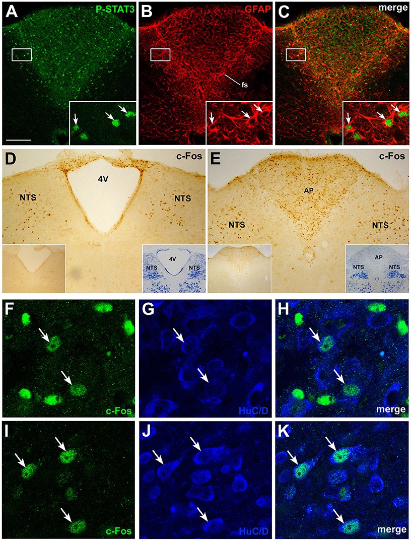 JessicaPerugin3's tweet photo. #PSTAT3 AND #CFOS #IMMUNOHISTOCHEMISTRY IN CORONAL #BRAINSTEM SECTIONS FROM MICE
https://t.co/Fi73QZ2DBg https://t.co/HLDy74p4Kz