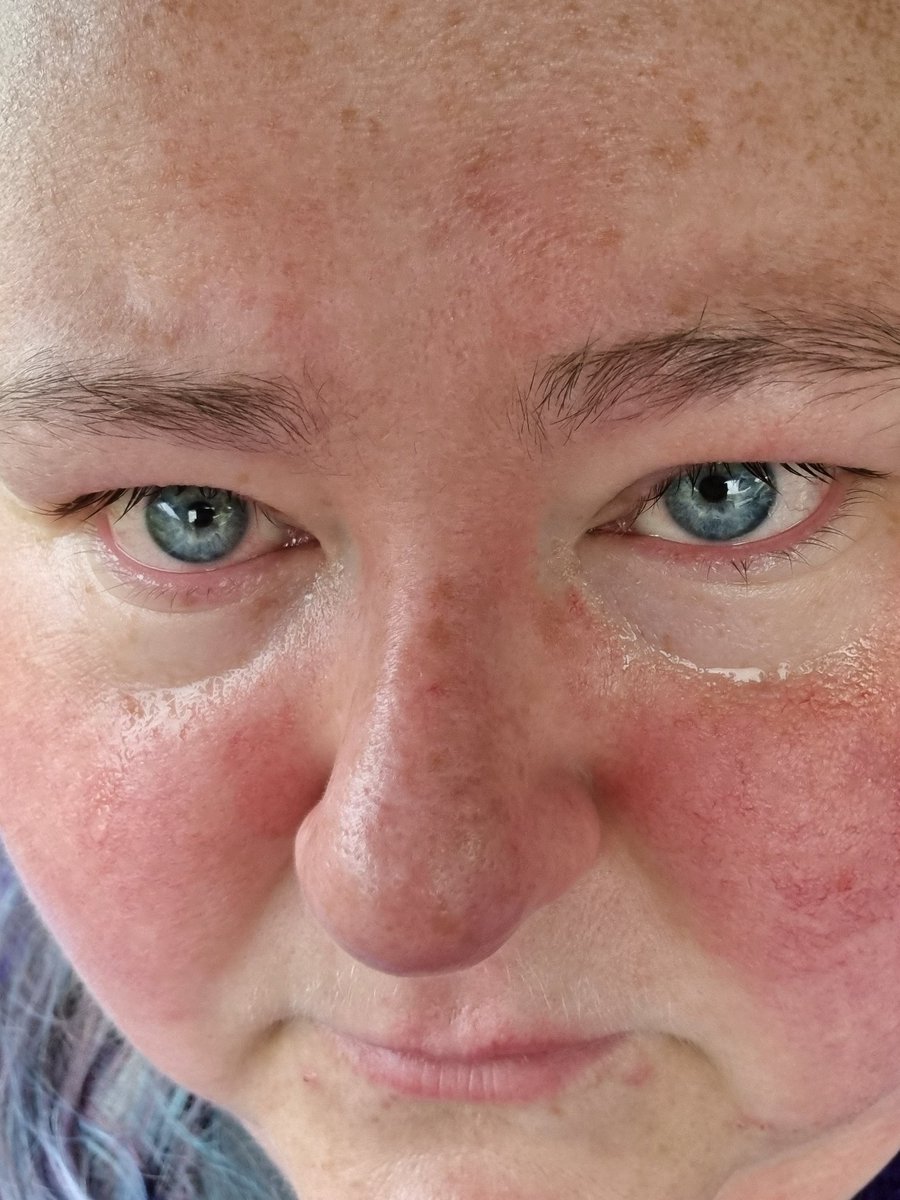 JoannaCash11's tweet photo. When a puppy is more than a family pet, a ptsd dog changes your life I don't think even I realised how much he helps me untill the micro chance of loosing him #crying #stateofme #ptsddog #sidekick #opp #lifeline #bipolar #bipolarclub #mentalhealth #PTSD #bpd #beautifulybroken https://t.co/rkUWegNnXq