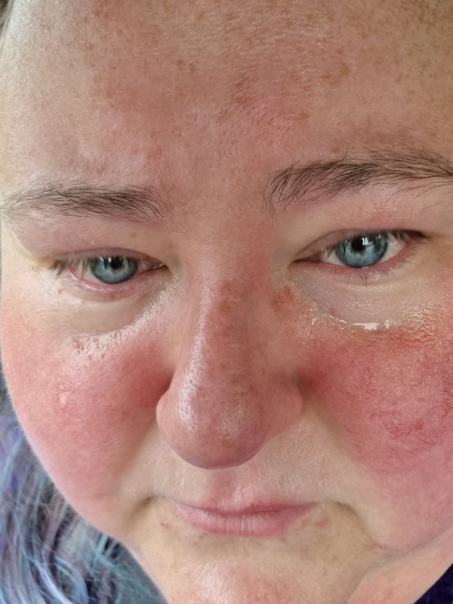 JoannaCash11's tweet photo. When a puppy is more than a family pet, a ptsd dog changes your life I don't think even I realised how much he helps me untill the micro chance of loosing him #crying #stateofme #ptsddog #sidekick #opp #lifeline #bipolar #bipolarclub #mentalhealth #PTSD #bpd #beautifulybroken https://t.co/rkUWegNnXq