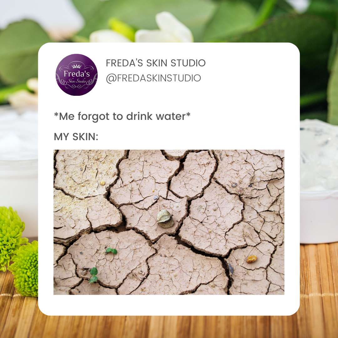 FredaSkinStudio's tweet photo. Many people underestimate the power of drinking water and the positive affects it can have on your skin and your overall health. Drinking more water is the most natural way to get that beaming, glowing and healthy skin we all want. Also helping with: 

💧 Sagging Skin
💧 Elas https://t.co/9tN7cEx50E
