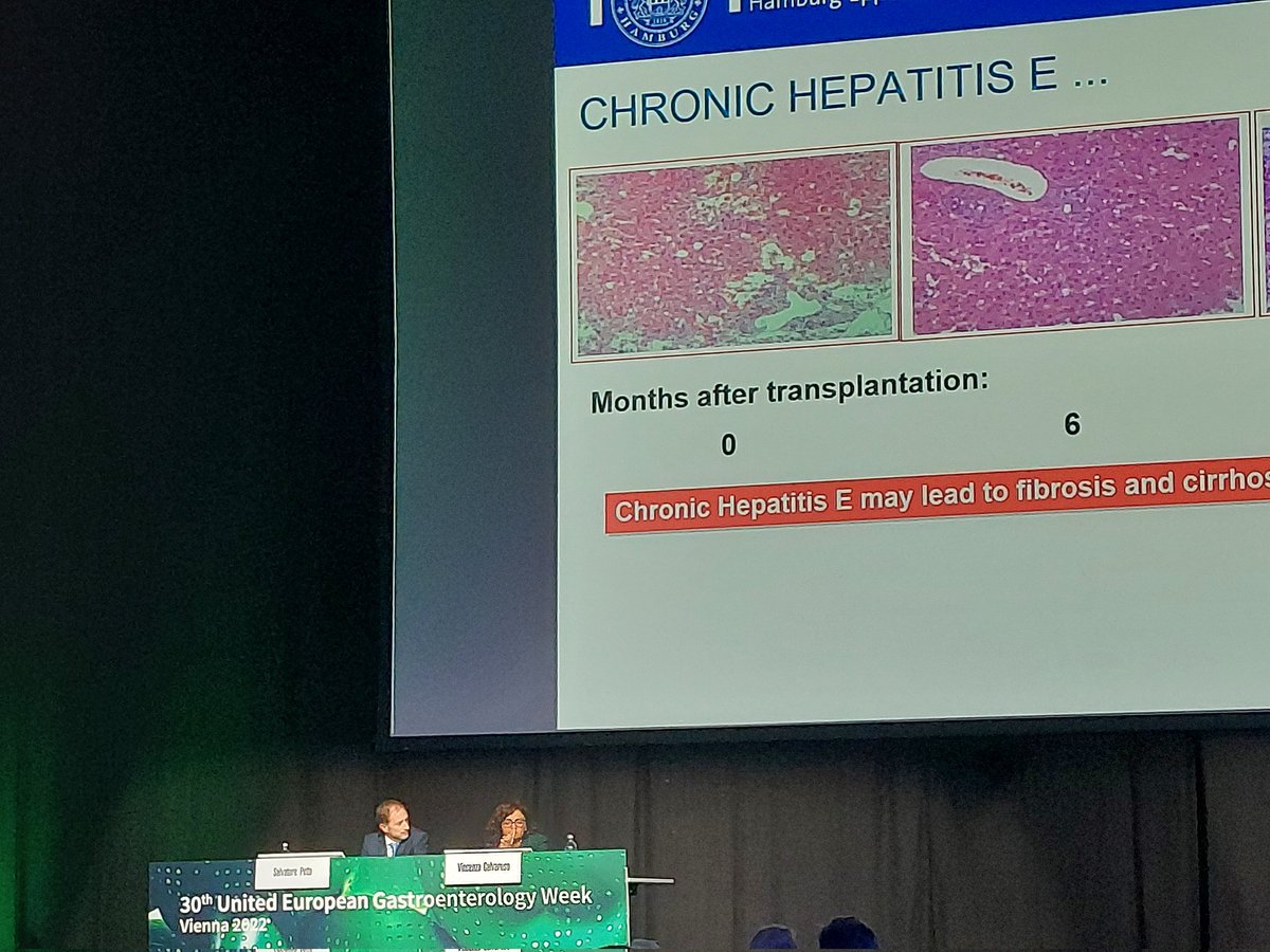 viral hepatitis: on its way out? #UEGweek
