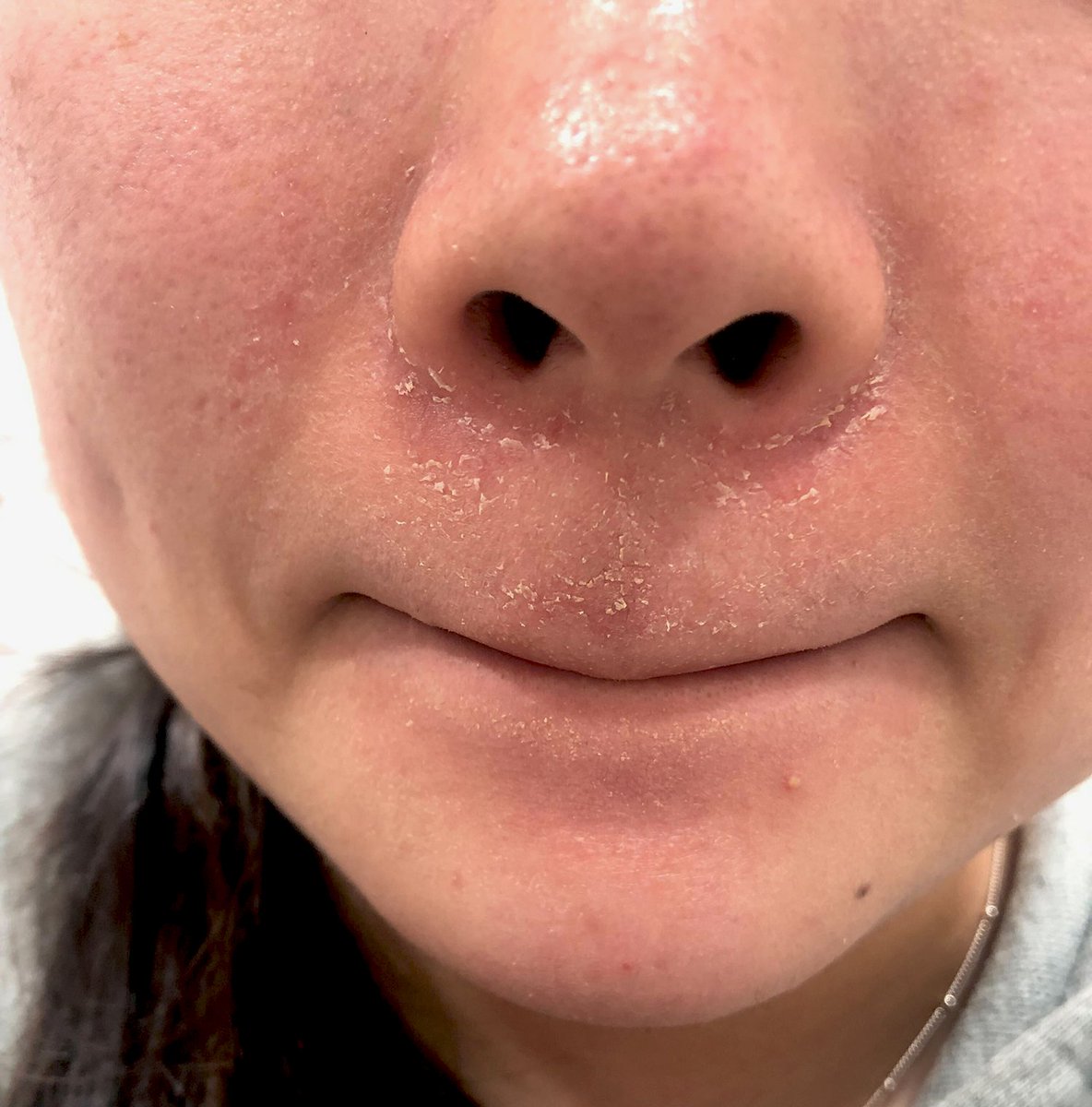 에부리 tweet media