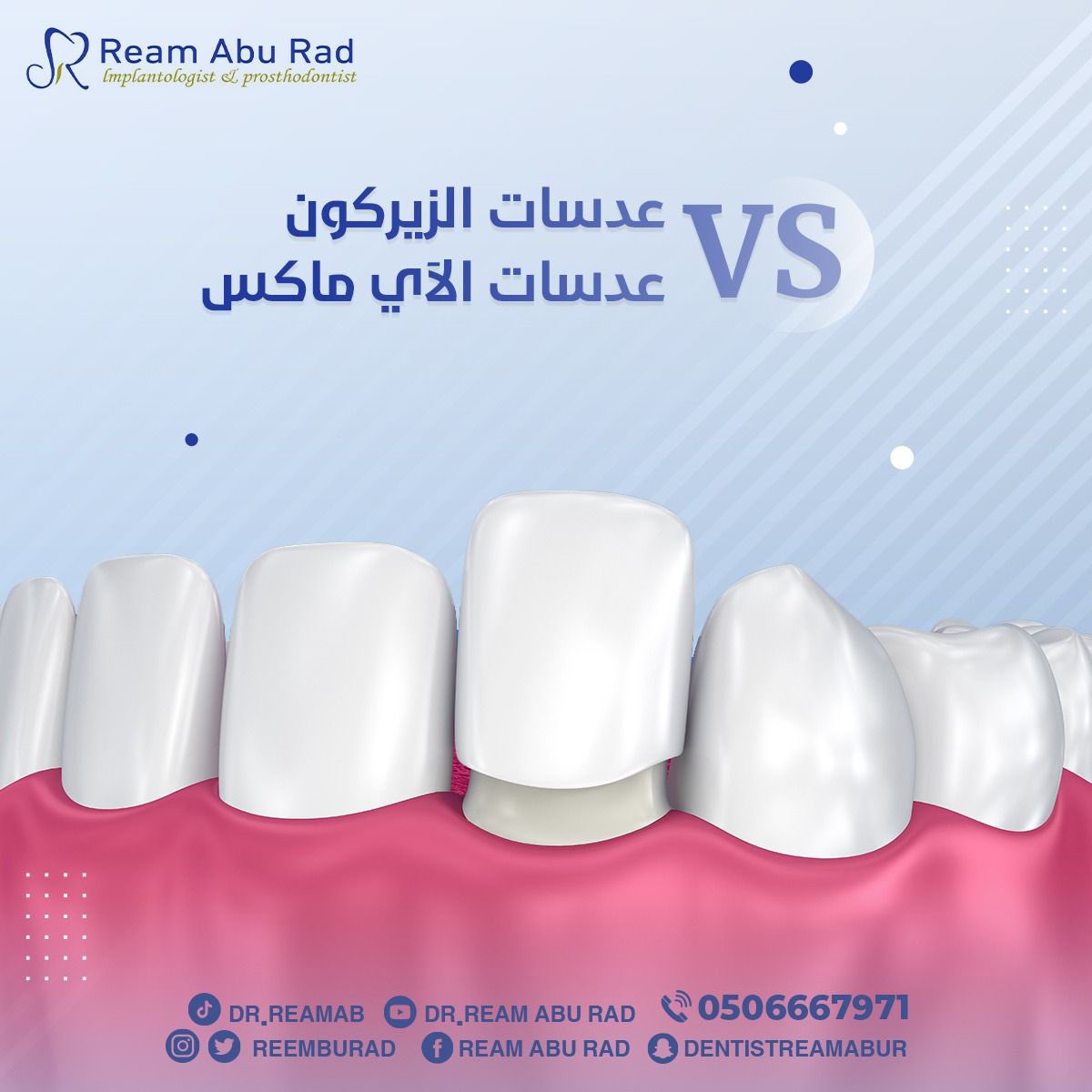 reemaburad's tweet photo. عدسات الزيركونVSعدسات الآي ماكس ✨

#الخبر #تجميل #علاجات #زراعة #ابتسامة #قبل_بعد #صباح_الخير #الجبيل #الشرقية #الظهران #تابعني #موسم #قرقيعان #فولو #حفلات #هوليوود #وناسة #عروض #مكياج https://t.co/Cys6mld2NN
