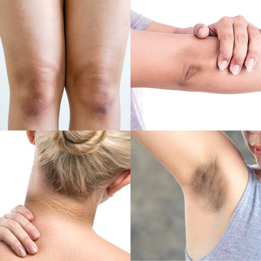 maharanilyss's tweet photo. Kumpulan produk treatment untuk mencerahkan lipatan kulit yg gelap

a thread https://t.co/CPthYVMS0w