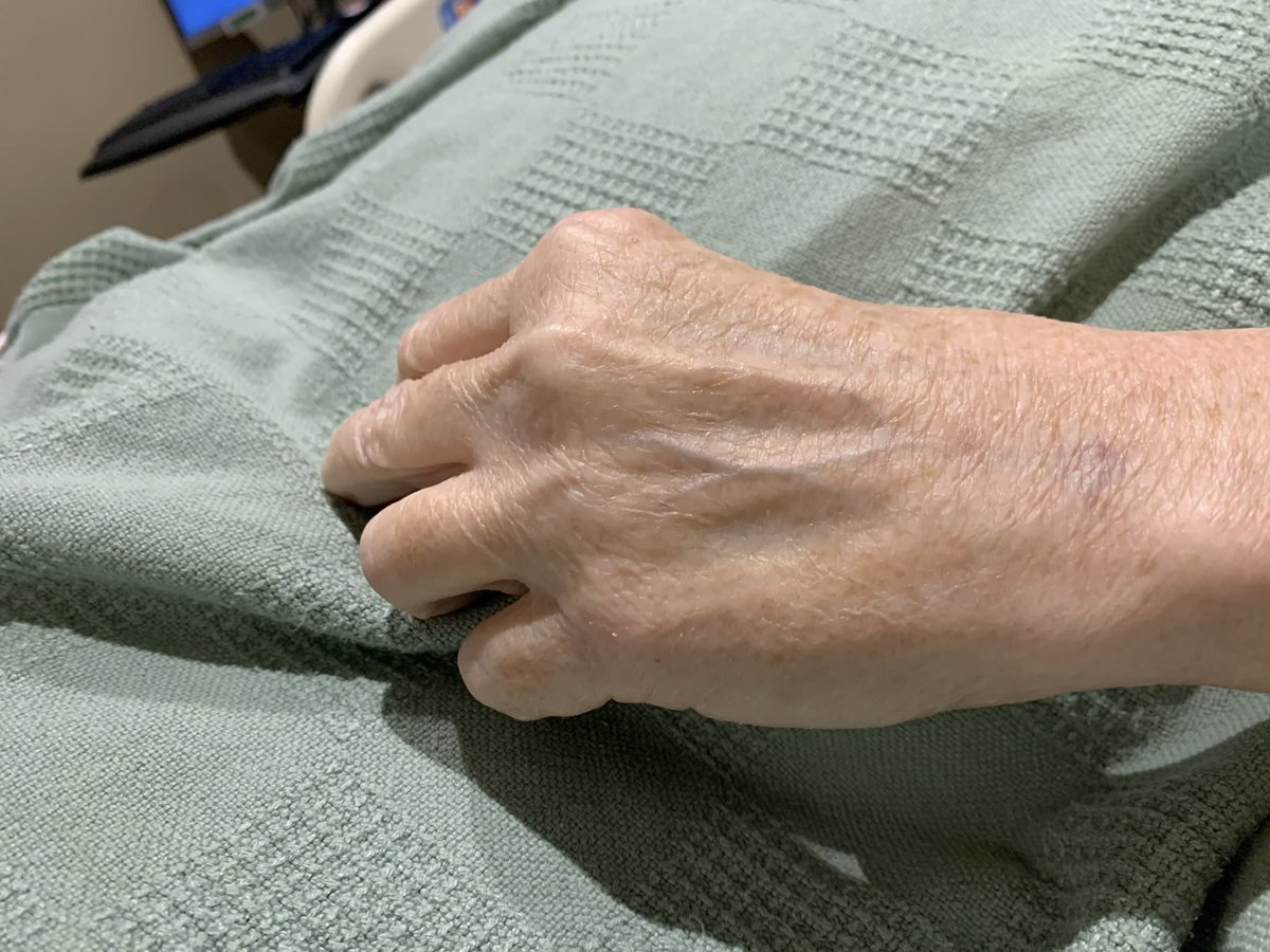 Stand4Patient's tweet photo. I do not take for granted the #healthcare providers who invested in our family and you #flatSharon. They made the difference. The ones who #touched our hearts. They made this hell bearable. #bethedifference https://t.co/fQ61mjqpkZ