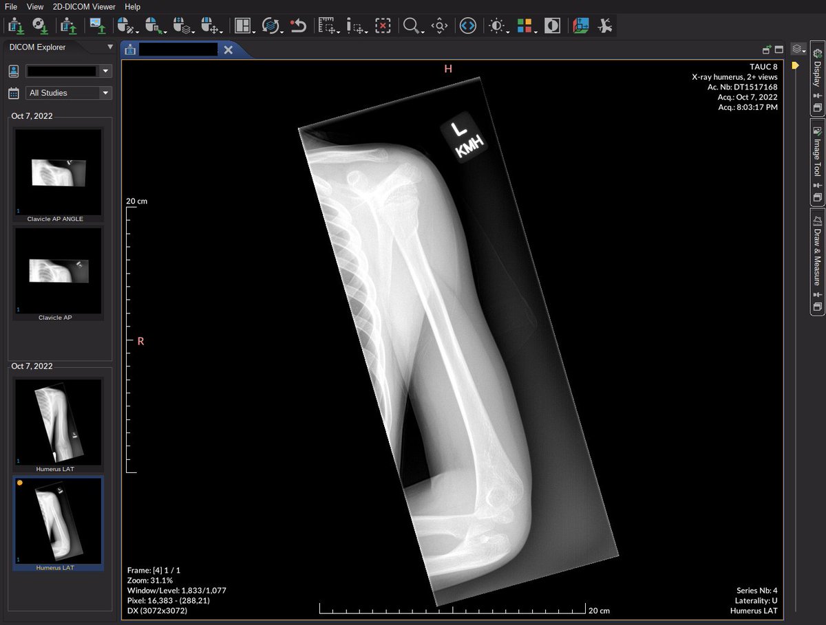 Joshua Ulrich tweet media