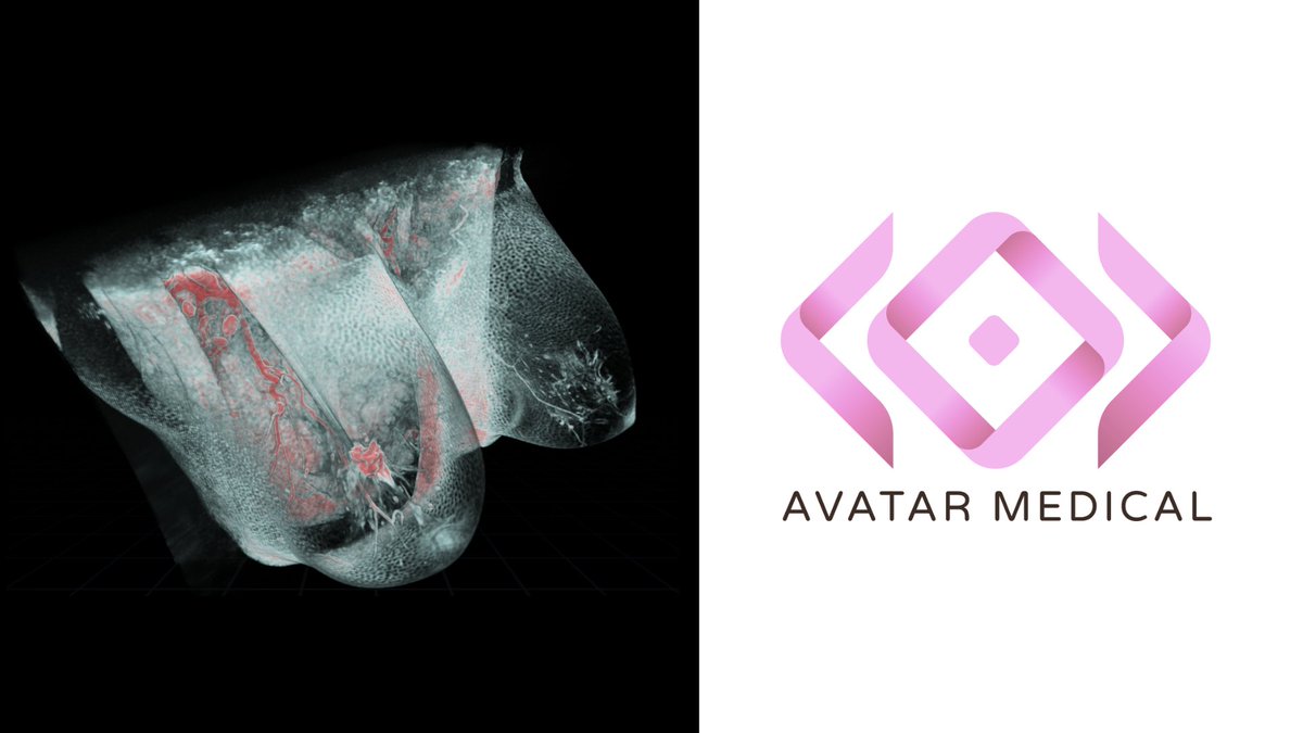 AVATAR MEDICAL turns pink in recognition of Breast Cancer Awareness month

Watch this video to understand how AVATAR MEDICAL is helping breast surgeons better plan their surgeries by transforming breast MRIs into interactive patient avatars: lnkd.in/dbWBQnKB

#pinktober
