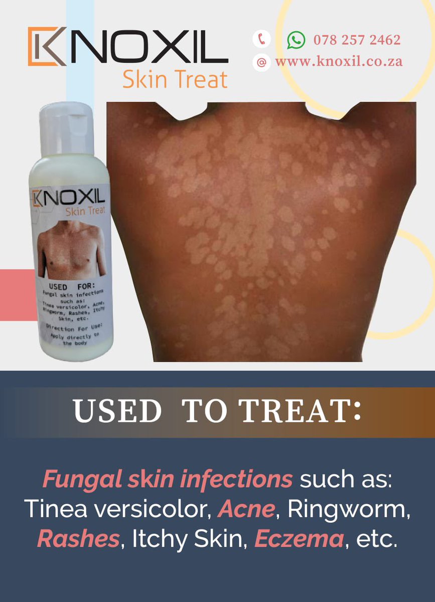 pnicezw's tweet image. What is the best medication/ cure for these things in Zim?