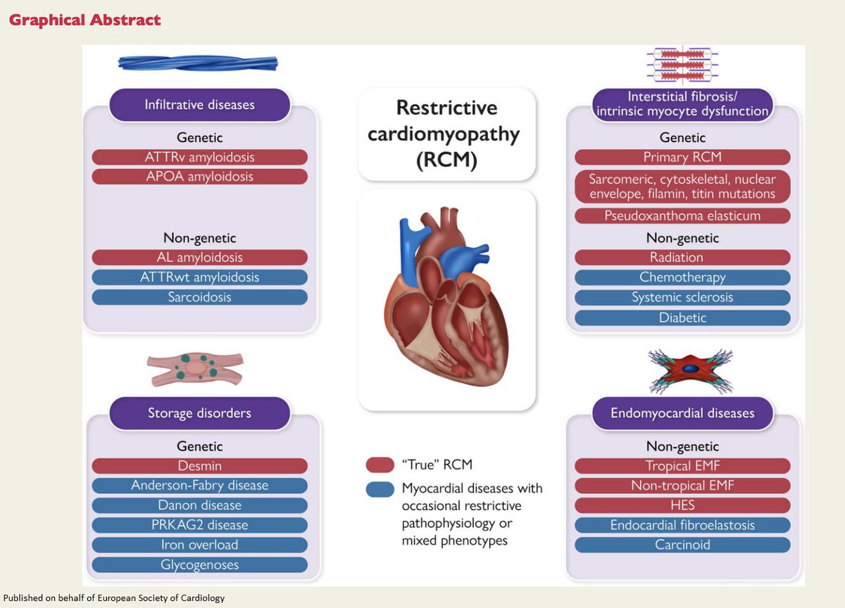 ESC_Journals's tweet photo. Restrictive cardiomyopathy: definition and diagnosis https://t.co/daIrkWe41i 

@escardio #EHJ #ESCYoung #cardiotwitter @ehj_ed @rladeiraslopes https://t.co/VaGAcsUqlV