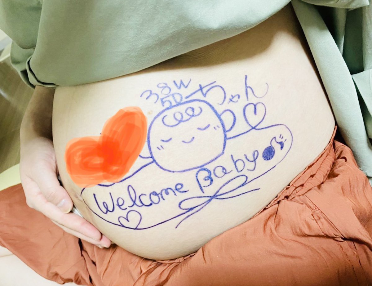 ゆいまる tweet media