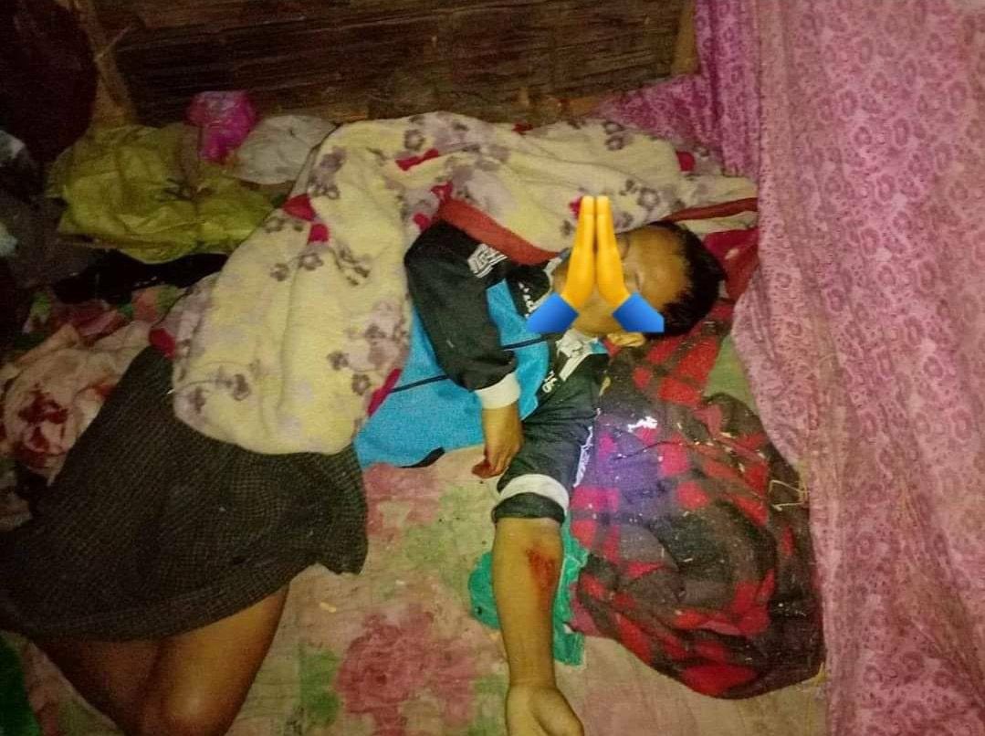 TTFR__Myanmar's tweet photo. Tw // death  On 23 October 2022 at 9pm, SAC targeted shelling motor to Khong Tar IDP camp in Loikaw Township. By shelling, one Man was killed and two person were injured.   #2022Oct24Coup  #WarCrimesOfJunta  #WhatsHappeningInMyanmar https://t.co/gFwBzpu6fT
