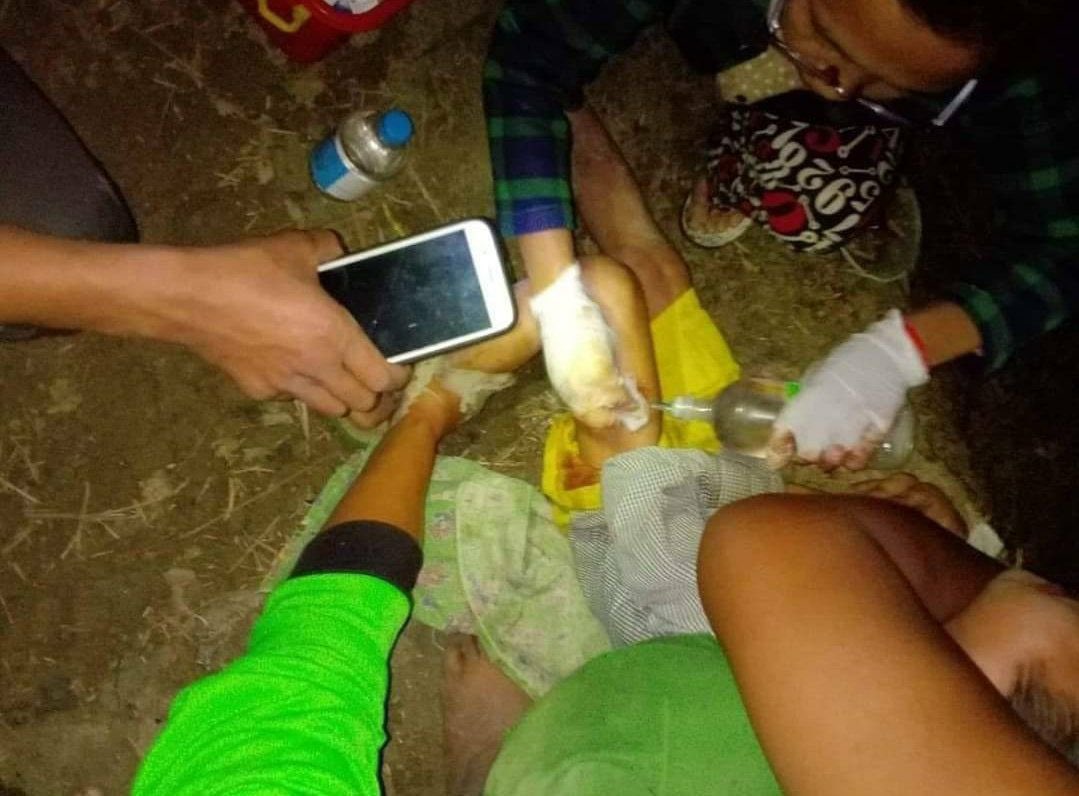 TTFR__Myanmar's tweet photo. Tw // death  On 23 October 2022 at 9pm, SAC targeted shelling motor to Khong Tar IDP camp in Loikaw Township. By shelling, one Man was killed and two person were injured.   #2022Oct24Coup  #WarCrimesOfJunta  #WhatsHappeningInMyanmar https://t.co/gFwBzpu6fT