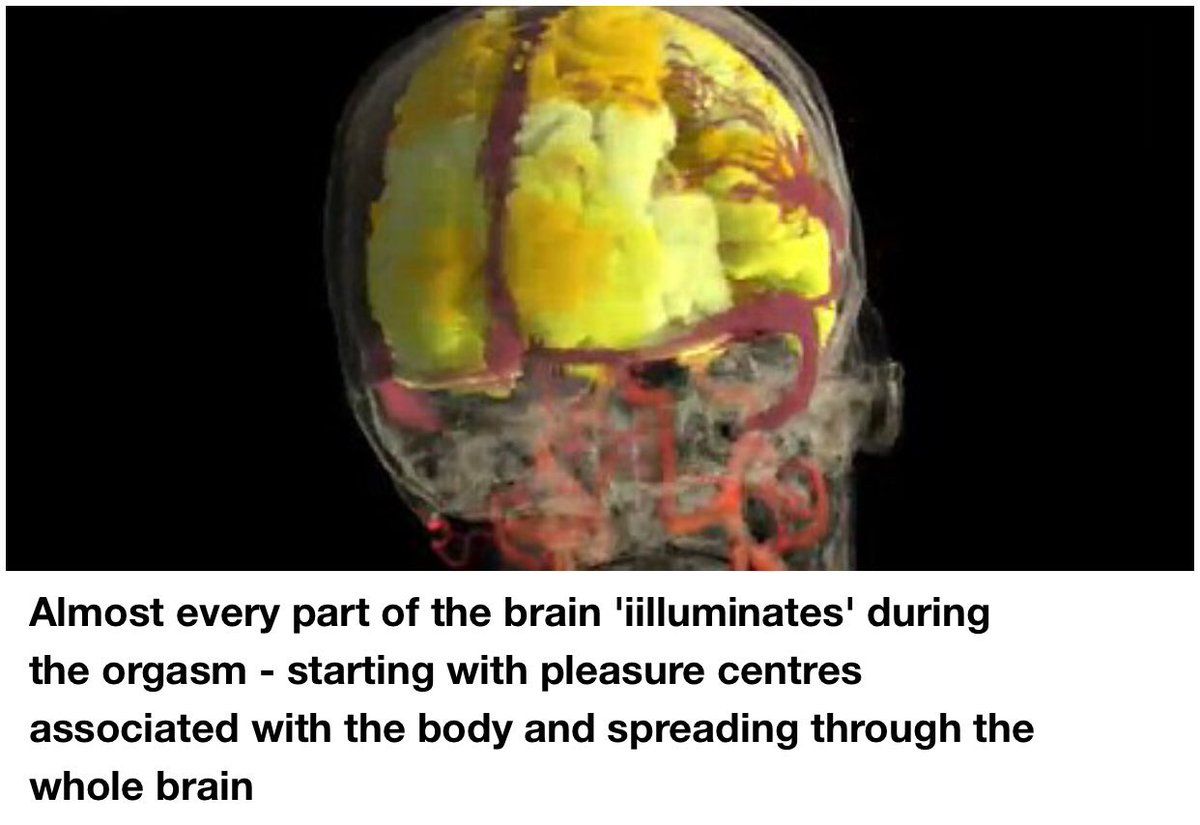 54岁的性治疗师Nan Wise自愿通过自慰达到性高潮并被采集大脑MRI影像

图中从暗红色区域活跃度最低，黄色/白色最高

性高潮时的大脑有超过80个区域变得活跃，几乎整个大脑都呈黄色，就像烟花表演

随高潮到来，下丘脑活动达到顶峰，会释放出催产素，后者会萌生满足感和安全信任感

高潮后，大脑活动消退