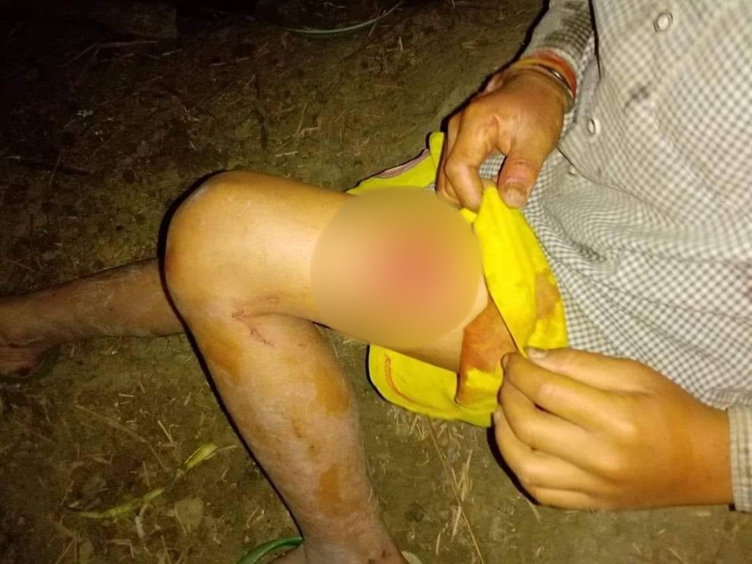 TheChindwin's tweet photo. The junta army’s shelling against the IDPs camp in Kungthar has killed a civilian and badly injured several IDPs, including a woman in the Loikaw township of Kayah state of Myanmar. https://t.co/jOkhbH12gh