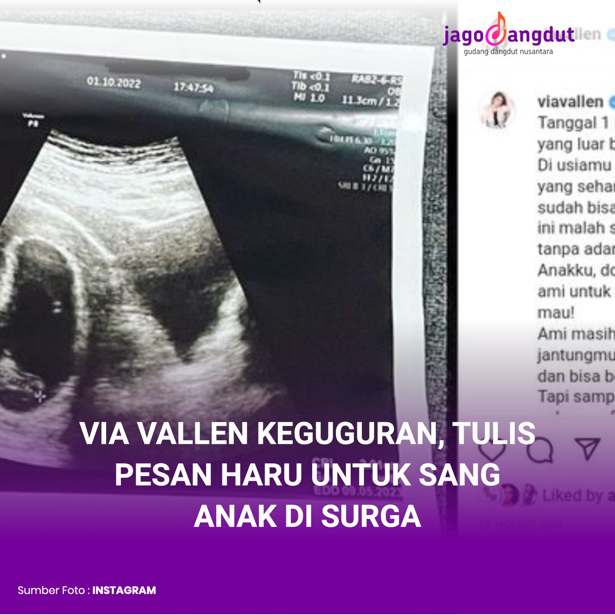 jagodangdutcom's tweet photo. Baru-baru ini para warganet di hebohkan dengan Via Vallen dalam postingannya beberapa waktu lalu. Istri dari Chevra Yolandi tersebut telah mengungkapkan kesedihan mendalamnya usai dirinya keguguran.
https://t.co/MDQGgVUHgM
__
#jagodangdut #dangdut #viavallen #chevra #viral https://t.co/0xtbDSw1mF