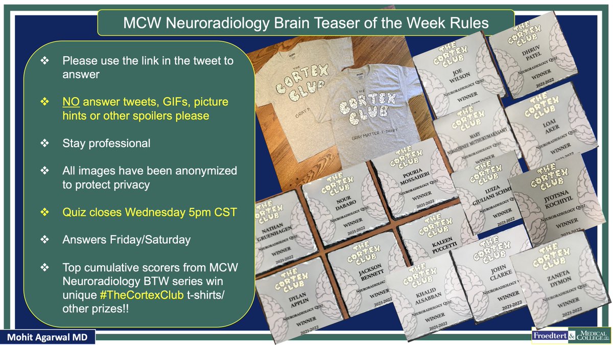 @X (@publishedxprime) on Twitter photo #MCWNeuroradBTW 087: Diplopia
QUIZ OPENS MON,CLOSES THU5PM
NO ANS/HINTS IN COMMENTS
Submit answers@ mcwisc.co1.qualtrics.com/jfe/form/SV_3f…
HAPPY DIWALI 🪔
#radres #MedEd #MedTwitter <a href="/TheASNR/">The American Society of Neuroradiology</a> <a href="/ARRS_Radiology/">ARRS</a> <a href="/BSHNI_UK/">British Society of Head & Neck Imaging</a> <a href="/BshniTrainees/">BSHNI Trainees</a> <a href="/RadDiscord/">RadDiscord</a> <a href="/MCWNeurorad/">MCW Neuroradiology</a> <a href="/ShivaprakashBH4/">Shivaprakash B. Hiremath</a> <a href="/ASHNRSociety/">ASHNR</a> #MCWNeuroradBTW 087: Diplopia
QUIZ OPENS MON,CLOSES THU5PM
NO ANS/HINTS IN COMMENTS
Submit answers@ mcwisc.co1.qualtrics.com/jfe/form/SV_3f…
HAPPY DIWALI 🪔
#radres #MedEd #MedTwitter <a href="/TheASNR/">The American Society of Neuroradiology</a> <a href="/ARRS_Radiology/">ARRS</a> <a href="/BSHNI_UK/">British Society of Head & Neck Imaging</a> <a href="/BshniTrainees/">BSHNI Trainees</a> <a href="/RadDiscord/">RadDiscord</a> <a href="/MCWNeurorad/">MCW Neuroradiology</a> <a href="/ShivaprakashBH4/">Shivaprakash B. Hiremath</a> <a href="/ASHNRSociety/">ASHNR</a>