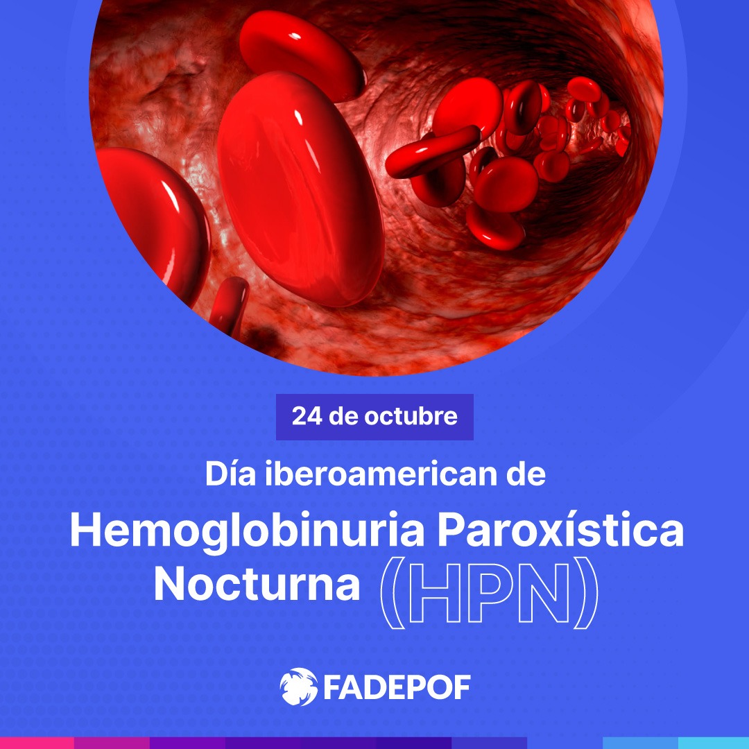 La Hemoglobinuria Paroxística Nocturna (HPN) una enfermedad rara en la cual los glóbulos rojos se descomponen antes de lo normal. 
#hemoglobinuriaparoxisticanocturna
#hemoglobinúriaparoxísticanoturna