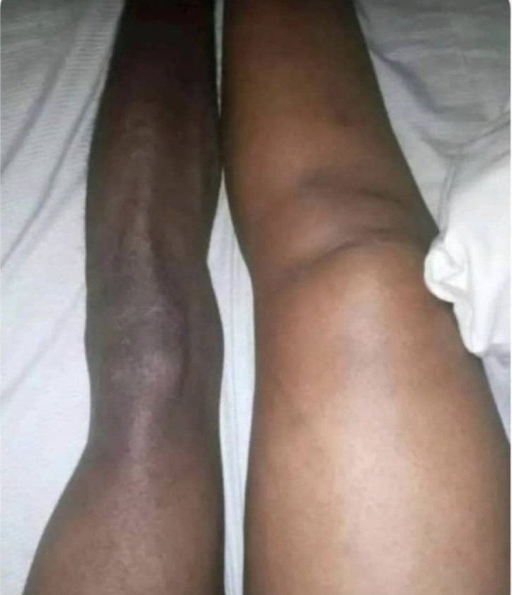 Moses89303431's tweet photo. The difference of the leg between the person who goes to work and brings in money and the one who enjoys that money https://t.co/X23tMrfuOC