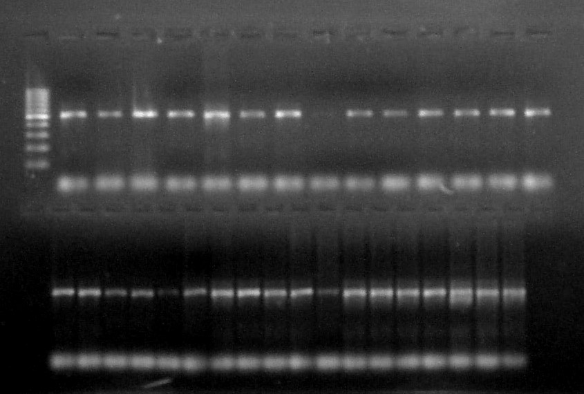 ESR2, InésGarcíaViñado is currently at Unibo working under the supervision of Prof. Paolo Trevisi. She is extracting DNA from CapSa samples to analyze the #gutmicrobiota and compare it with gut samples extracted directly from the pig. Her objective is to validate CapSa sampling
