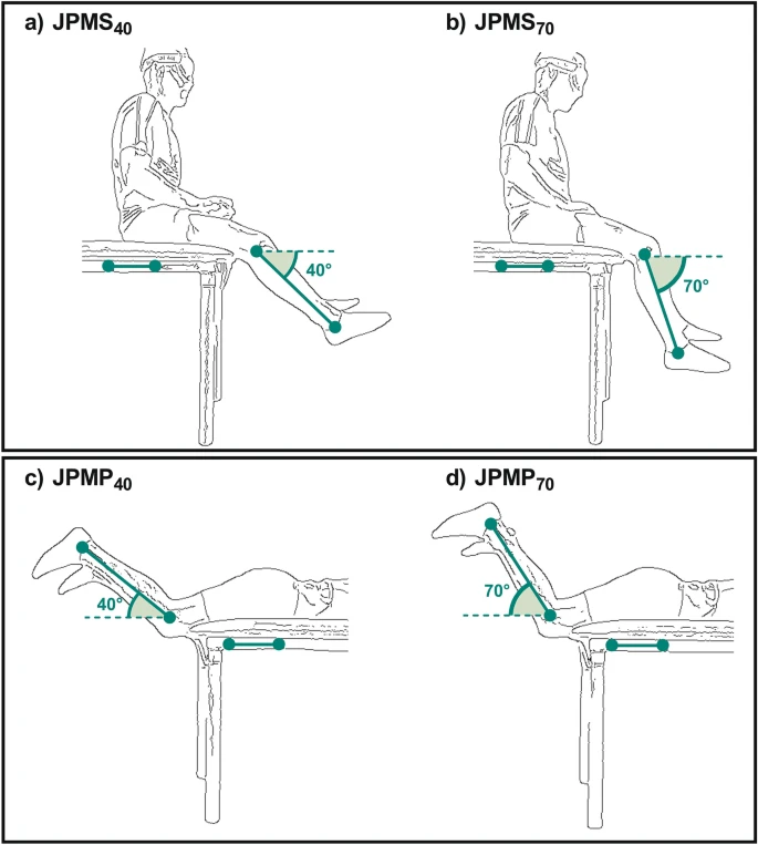 Knee position sense and knee flexor neuromuscular function are similarly altered after two submaximal eccentric bouts. By FD Silva & @SergeColson et al @lamhessUCA @Univ_CotedAzur @eur_healthy #eccentric #proprioception #fatigue rdcu.be/cX9lu