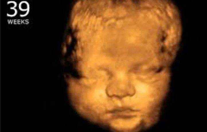 Killing More Babies in Abortions Will Not Reduce Inflation buff.ly/3MYSeUi